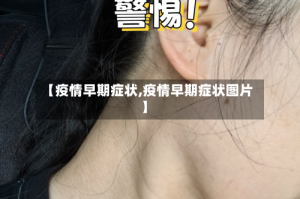 【疫情早期症状,疫情早期症状图片】