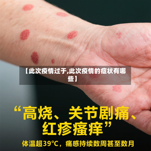 【此次疫情过于,此次疫情的症状有哪些】-第1张图片