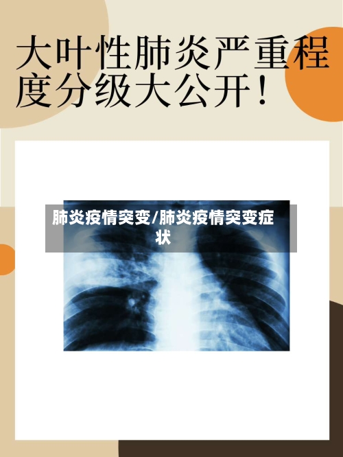 肺炎疫情突变/肺炎疫情突变症状-第1张图片