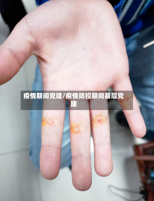 疫情期间党建/疫情防控期间基层党建-第1张图片