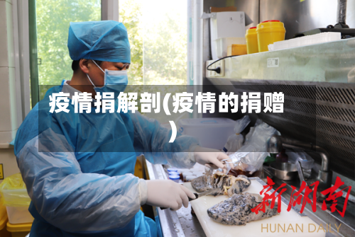 疫情捐解剖(疫情的捐赠)-第1张图片