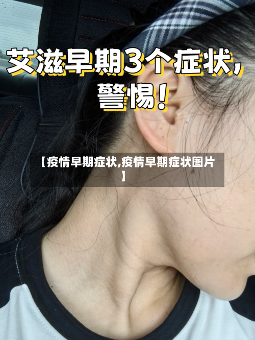 【疫情早期症状,疫情早期症状图片】-第1张图片